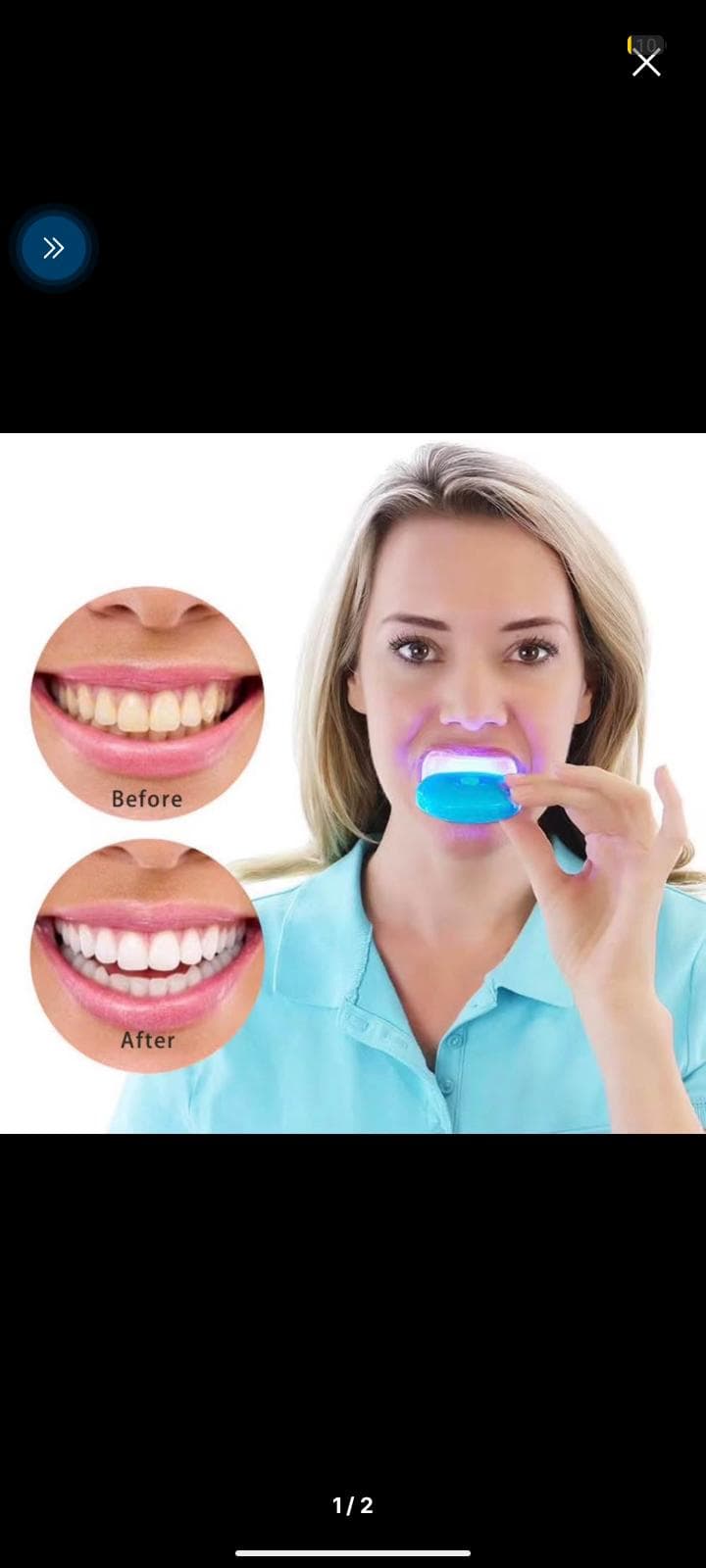 Éclairage de dents  — photo 1